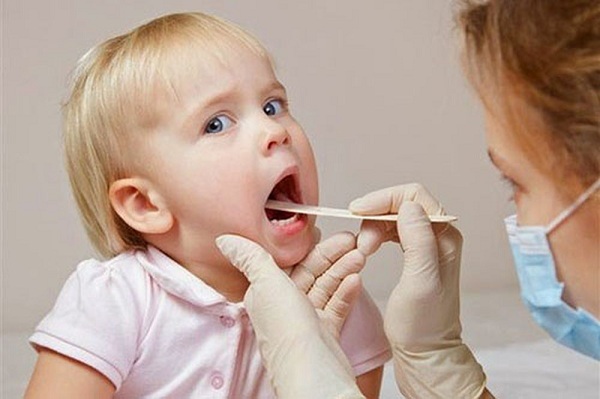 chữa viêm họng cho bé không dùng kháng sinh